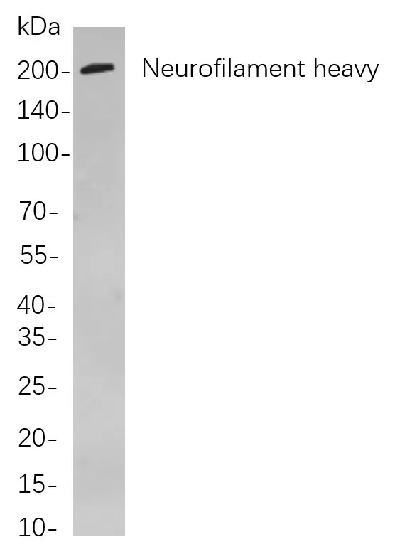 Neurofilament heavy polypeptide Rabbit Monoclonal Antibody - Size: 200µL