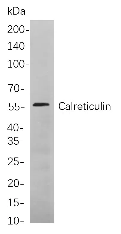 CalreticµLin Rabbit Monoclonal Antibody - Size: 100µL