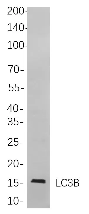 LC3B Rabbit Monoclonal Antibody