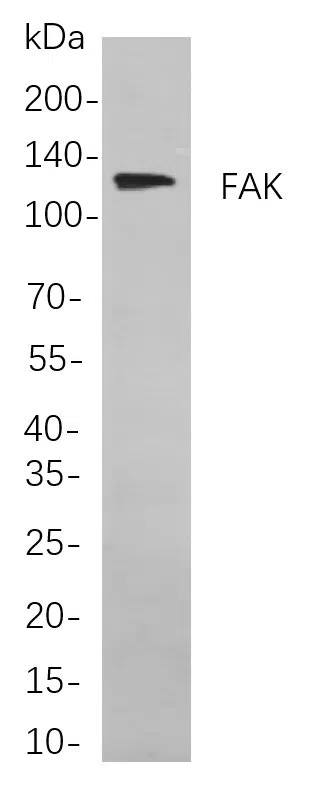 FAK Rabbit Monoclonal Antibody - Size: 100µL