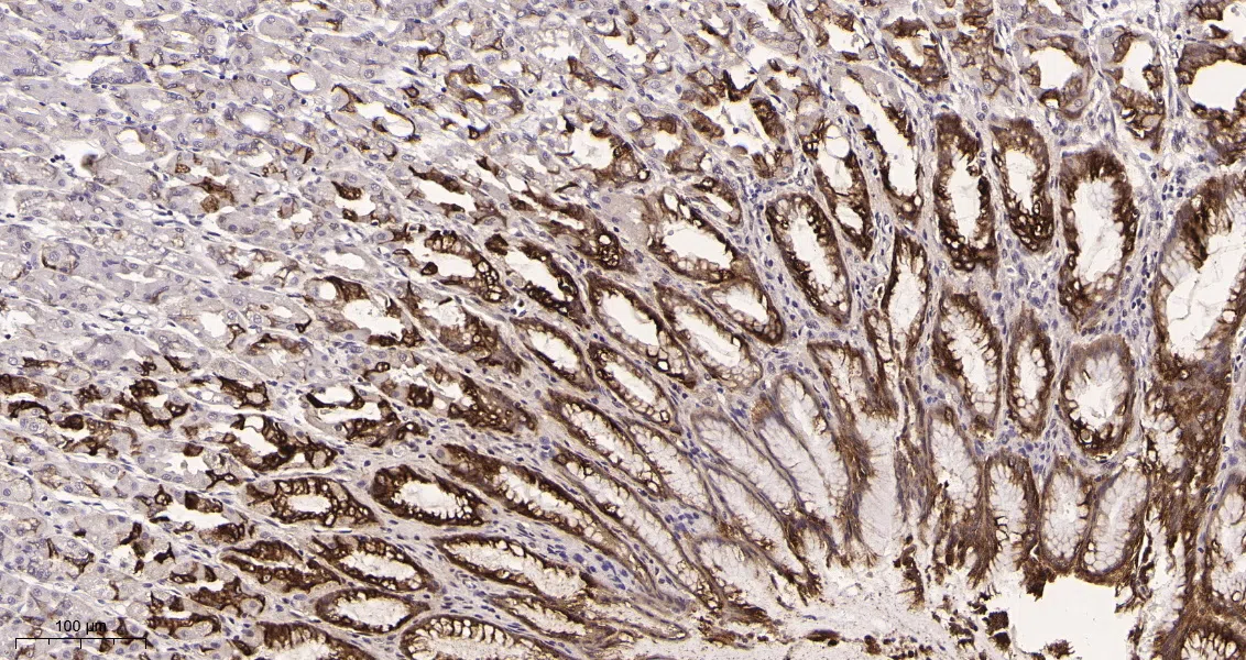 Immunohistochemistry(IHC) - Mucin 5AC Rabbit Monoclonal Antibody AMRe21538