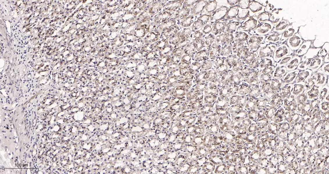 Immunohistochemistry(IHC) - Mucin 5AC Rabbit Monoclonal Antibody AMRe21538