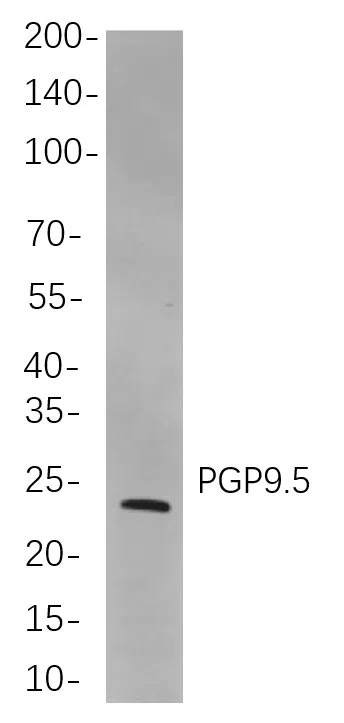 PGP9.5 Rabbit Monoclonal Antibody - Size: 100µL