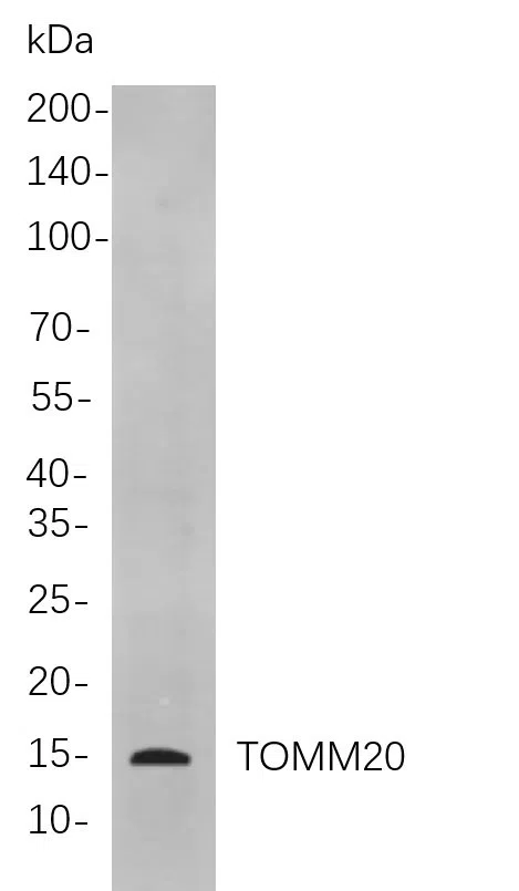 TOMM20 Rabbit Monoclonal Antibody - Size: 100µL