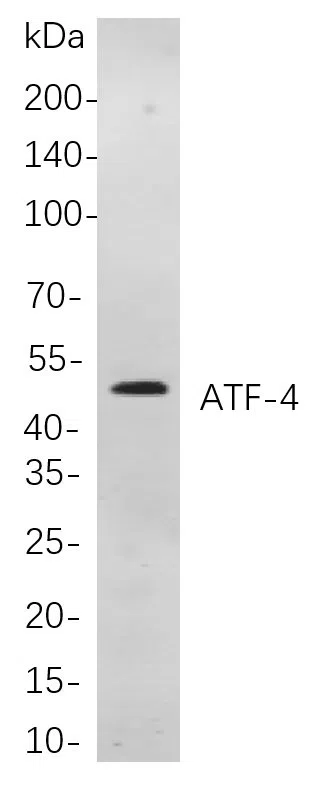 ATF-4 Rabbit Monoclonal Antibody - Size: 50µL
