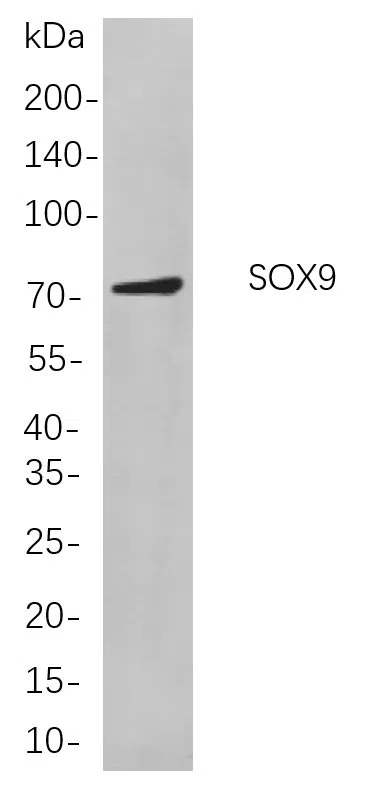 SOX9 Rabbit Monoclonal Antibody - Size: 50µL