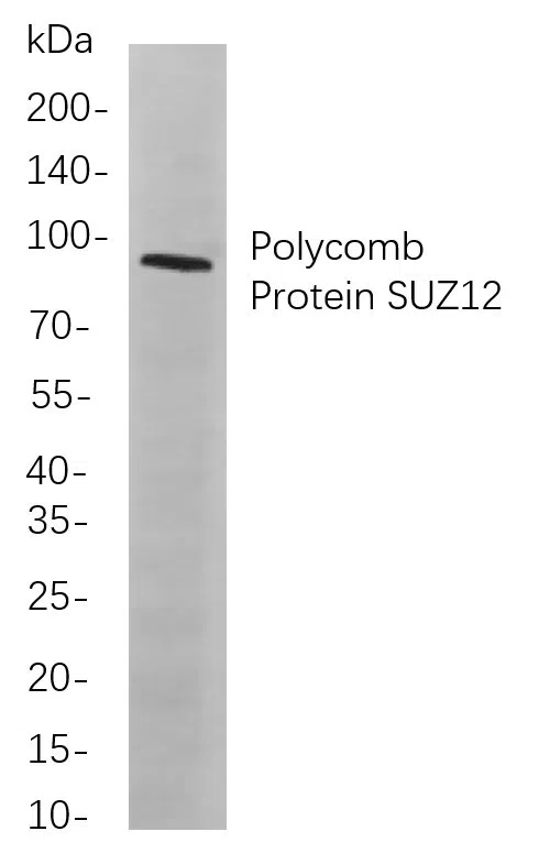 Polycomb Protein SUZ12 Rabbit Monoclonal Antibody - Size: 100µL