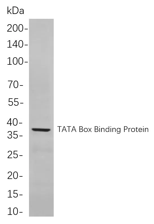 TATA Box Binding Protein Rabbit Monoclonal Antibody - Size: 100µL