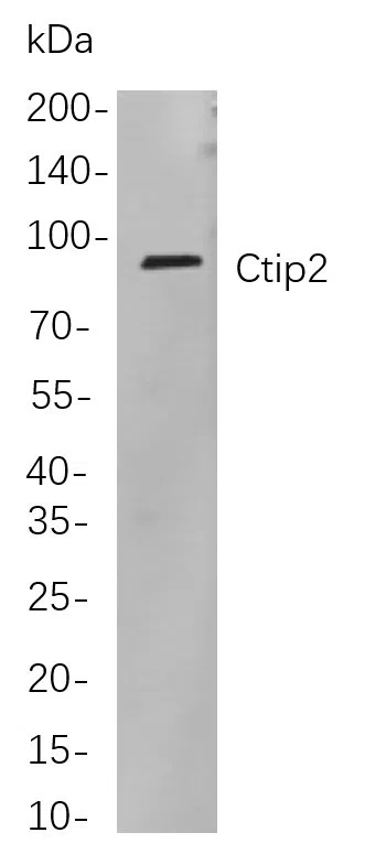 Ctip2 Rabbit Monoclonal Antibody - Size: 50µL