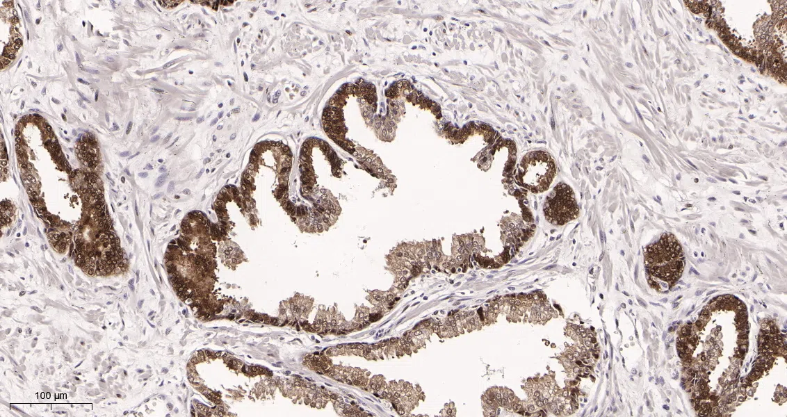 Hsp70 Rabbit Monoclonal Antibody