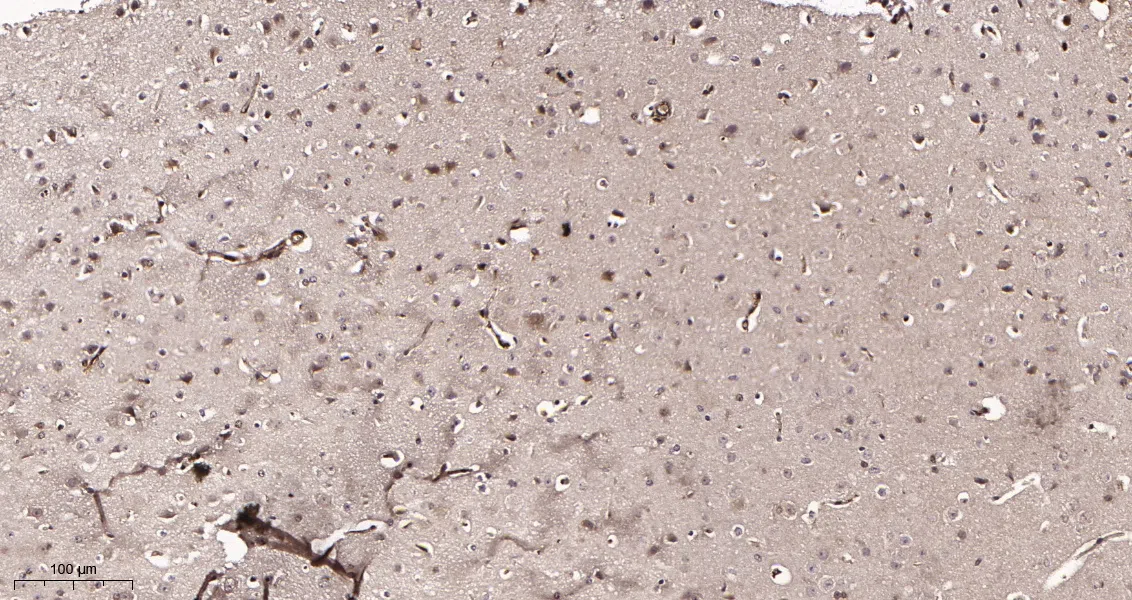 Hsp70 Rabbit Monoclonal Antibody