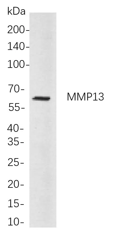 MMP13 Rabbit Monoclonal Antibody - Size: 100µL