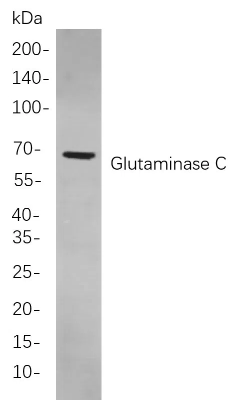 Glutaminase C Rabbit Monoclonal Antibody - Size: 100µL