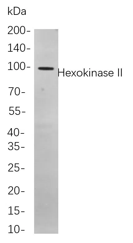 Hexokinase II Rabbit Monoclonal Antibody - Size: 200µL