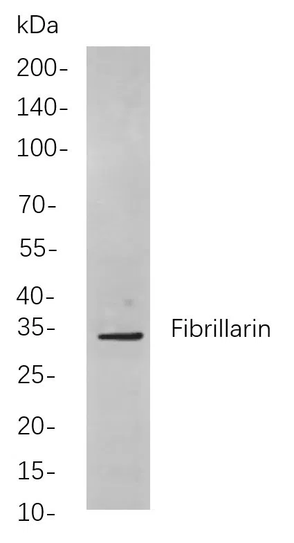 Fibrillarin Rabbit Monoclonal Antibody - Size: 50µL