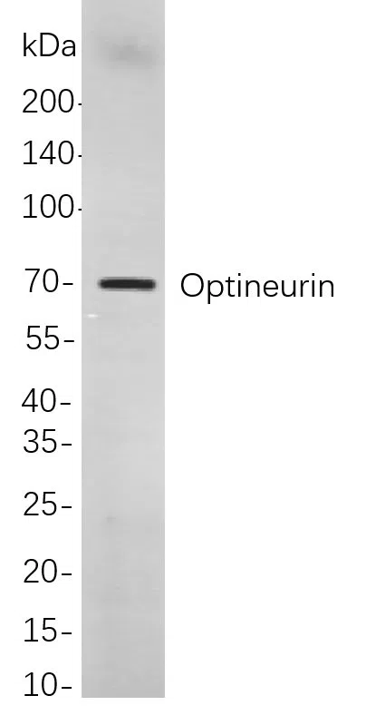 Optineurin Rabbit Monoclonal Antibody - Size: 200µL