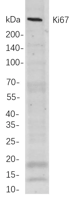 Ki67 Rabbit Monoclonal Antibody