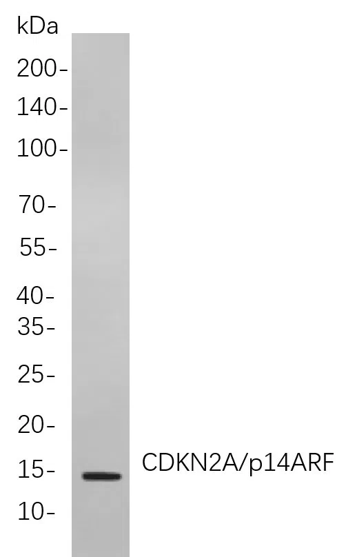 CDKN2A/p14ARF Rabbit Monoclonal Antibody - Size: 100µL