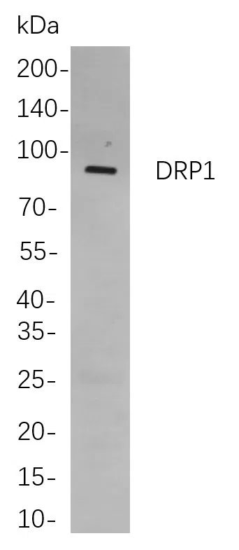 DRP1 Rabbit Monoclonal Antibody - Size: 50µL