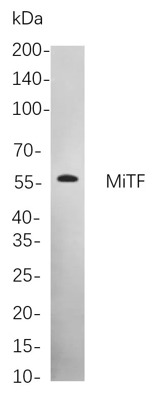 MiTF Rabbit Monoclonal Antibody - Size: 200µL