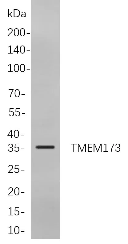 TMEM173 Rabbit Monoclonal Antibody - Size: 200µL