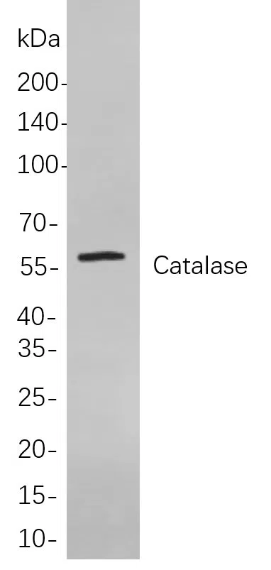 Catalase Rabbit Monoclonal Antibody - Size: 200µL
