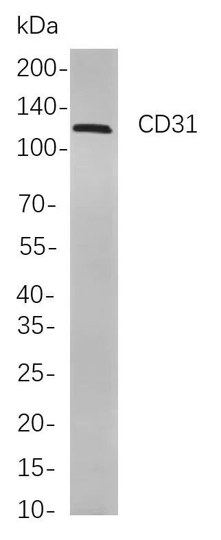 CD31 Rabbit Monoclonal Antibody