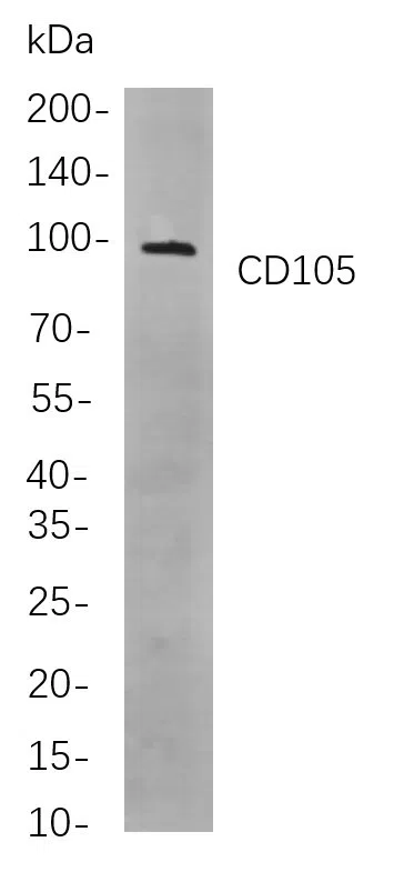 CD105 Rabbit Monoclonal Antibody - Size: 50µL