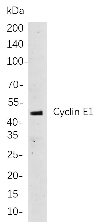 Cyclin E1 Rabbit Monoclonal Antibody - Size: 200µL