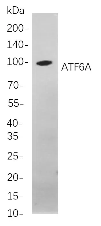 ATF6A Rabbit Monoclonal Antibody - Size: 200µL
