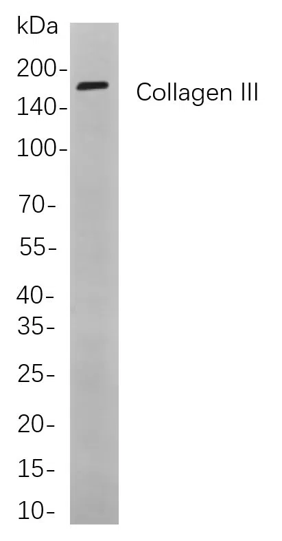 Collagen III Rabbit Monoclonal Antibody - Size: 50µL
