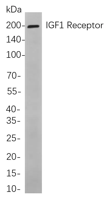 IGF1 Receptor Rabbit Monoclonal Antibody - Size: 100µL