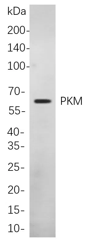PKM Rabbit Monoclonal Antibody - Size: 100µL