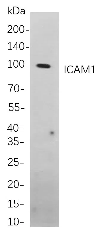 ICAM1 Rabbit Monoclonal Antibody - Size: 200µL