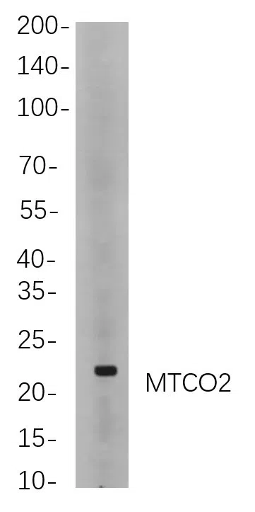 MTCO2 rabbit Rabbit Monoclonal Antibody - Size: 50µL
