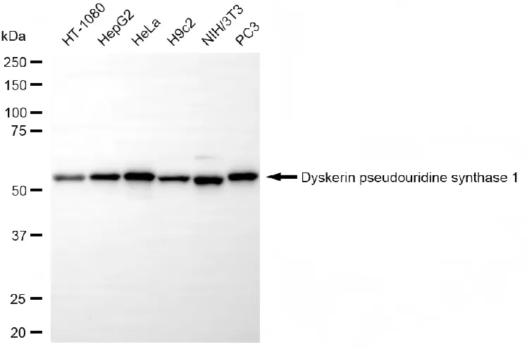 WesternBlot(WB) - KD-Validated Dyskerin Pseudouridine Synthase 1 Recombinant Rabbit Monoclonal Antibody KVAb00009