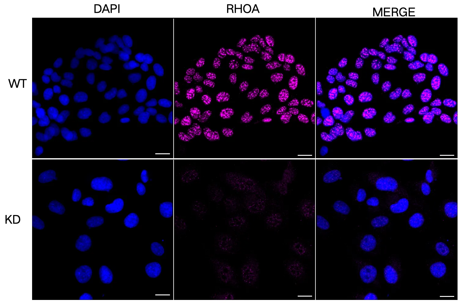KD Validation ICC-RhoA 