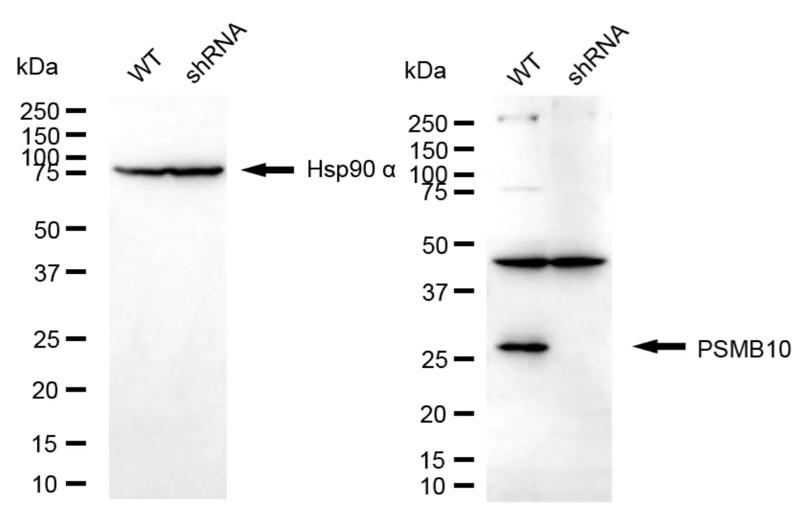 KD-Validated Proteasome 20S Subunit Beta 10 Recombinant Rabbit Monoclonal Antibody