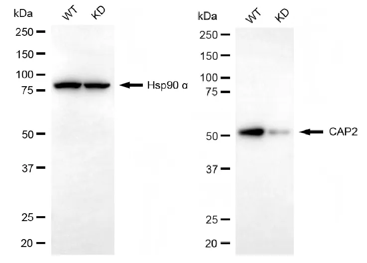 KD-Validated CAP2 Recombinant Rabbit Monoclonal Antibody
