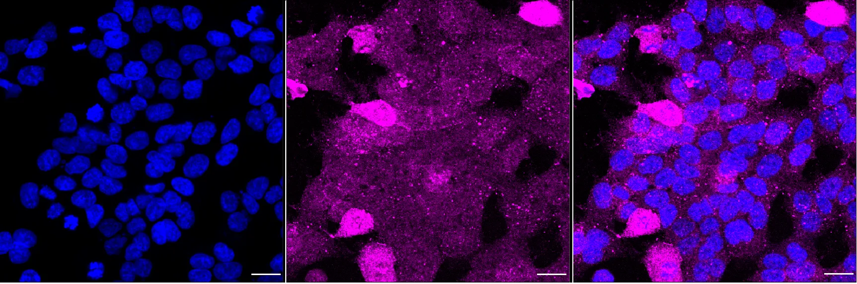 Immunocytochemistry(ICC) - KO-Validated AKT Serine/Threonine Kinase 1 Recombinant Rabbit Monoclonal Antibody KVAb00032