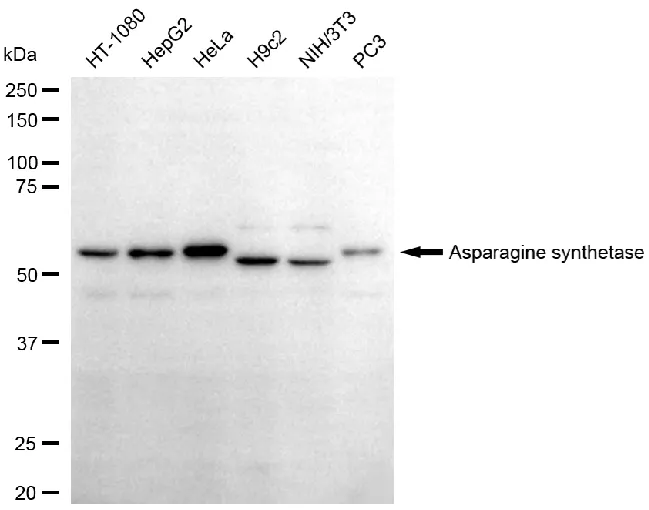 WesternBlot(WB) - KO-Validated Asparagine Synthetase Recombinant Rabbit Monoclonal Antibody KVAb00057