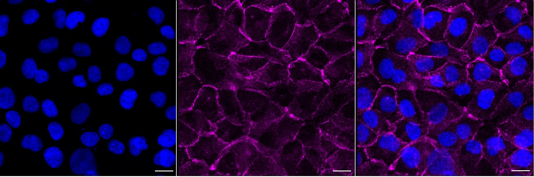 Immunocytochemistry(ICC) - KO-Validated Catenin Beta 1 Mouse Monoclonal Antibody KVAb00075