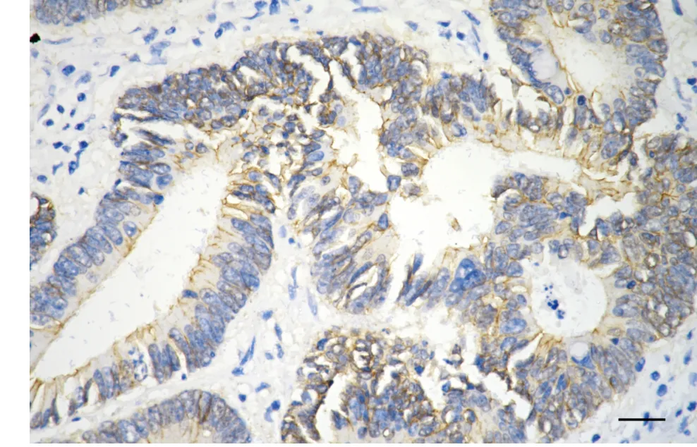 Immunohistochemistry(IHC) - KO-Validated Catenin Beta 1 Mouse Monoclonal Antibody KVAb00075