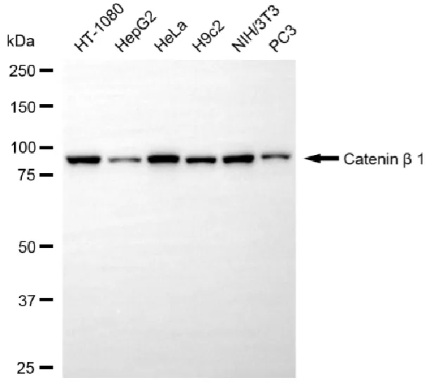 WesternBlot(WB) - KO-Validated Catenin Beta 1 Mouse Monoclonal Antibody KVAb00075