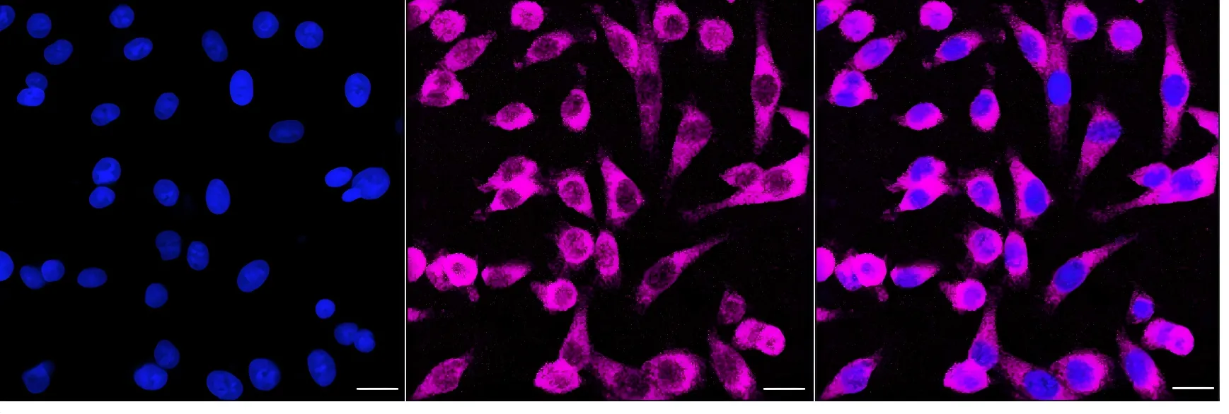 Immunocytochemistry(ICC) - KO-Validated EIF2AK2 Recombinant Rabbit Monoclonal Antibody KVAb00086