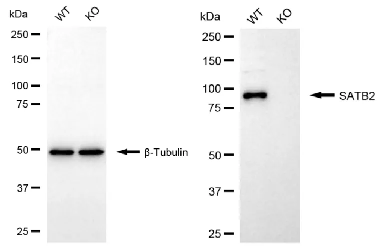 KO Validation WB-SATB2