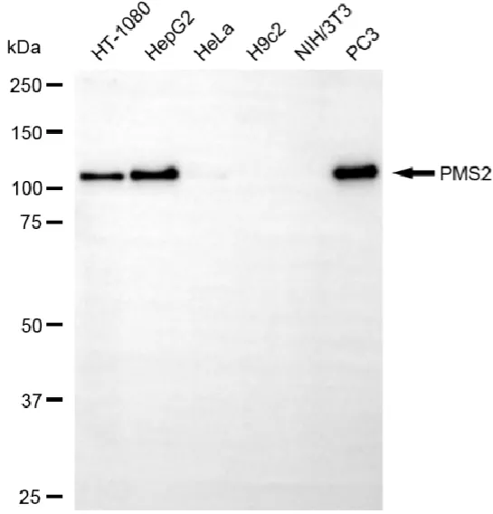 WesternBlot(WB) - KO-Validated PMS2 Recombinant Rabbit Monoclonal Antibody KVAb00099