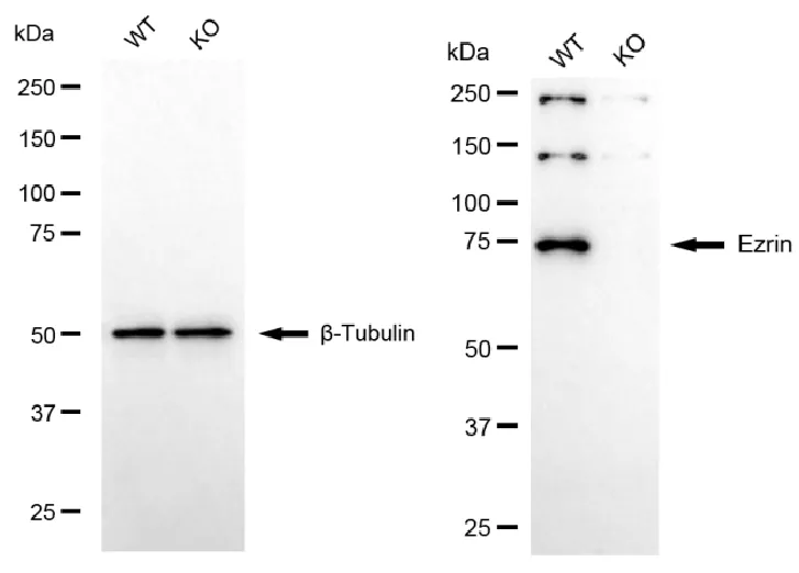 KO-Validated Ezrin Recombinant Rabbit Monoclonal Antibody