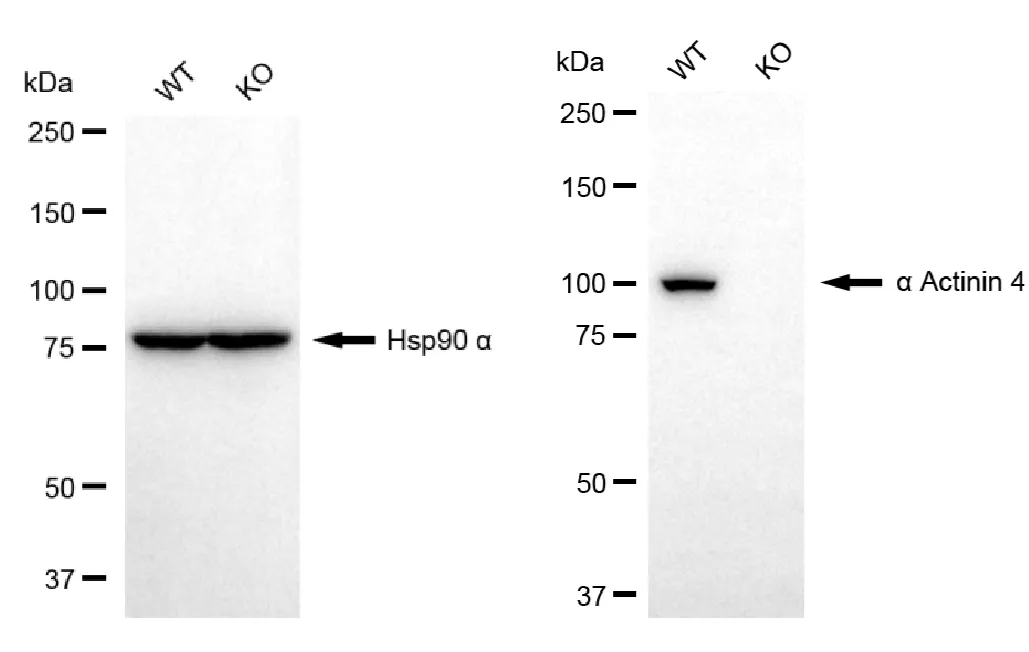 KO-Validated Actinin Alpha 4 Recombinant Rabbit Monoclonal Antibody