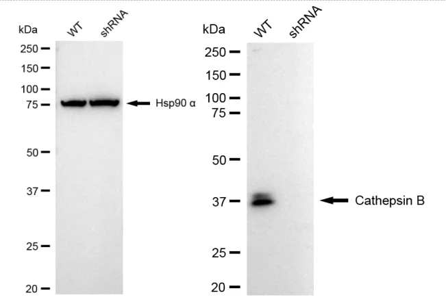 KD-Validated Cathepsin B Recombinant Rabbit Monoclonal Antibody